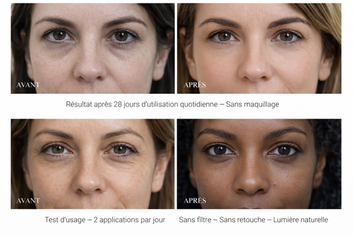 Soin Anti-cernes puissant - Hydrate - Lifte - Repulpe