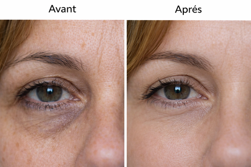 Soin anti-cernes instantané - Rides et poches yeux